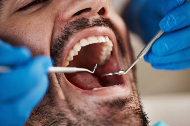Best Emergency Treatment for Toothache in Macedonia, OH