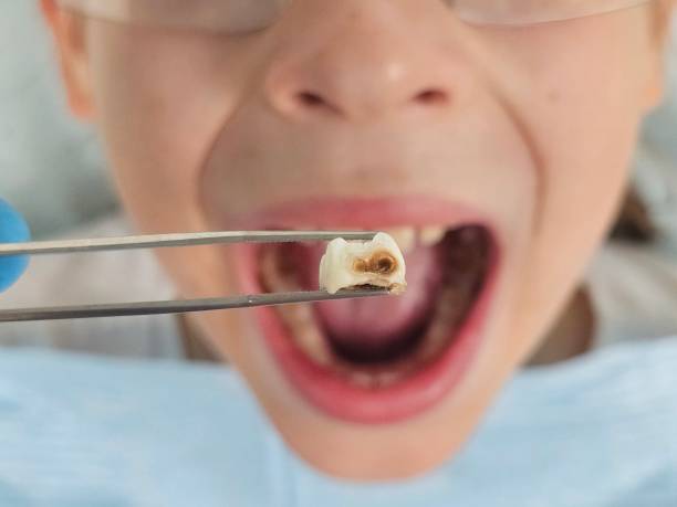 Best Emergency Broken Tooth Repair in Macedonia, OH